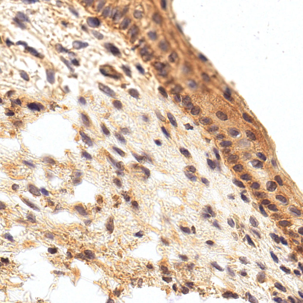 sars-cov-2 gene expression in a human fetus